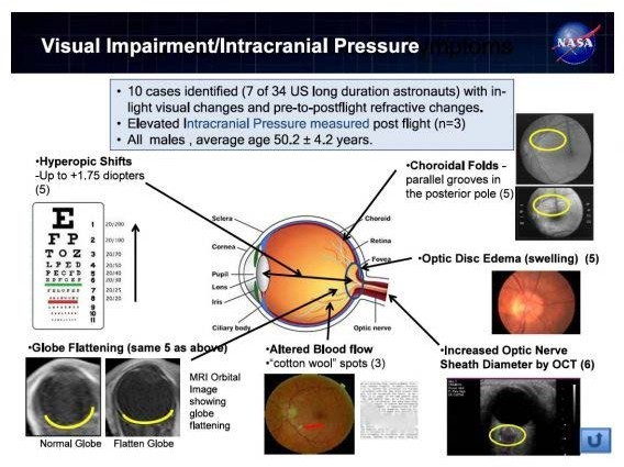 visual impairment pressure